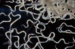Mass of nematodes